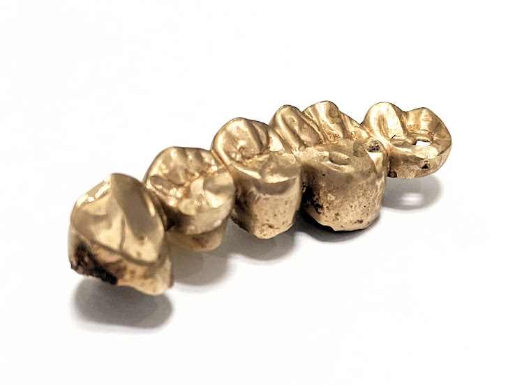 金歯,貴金属,買取