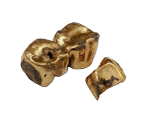 金歯,貴金属,金