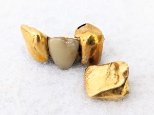 金歯,買取,市原市