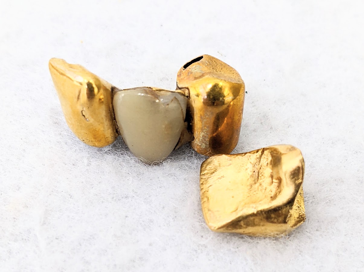 金歯,買取,市原市